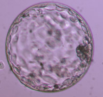 Expanded blastocyst 4BB